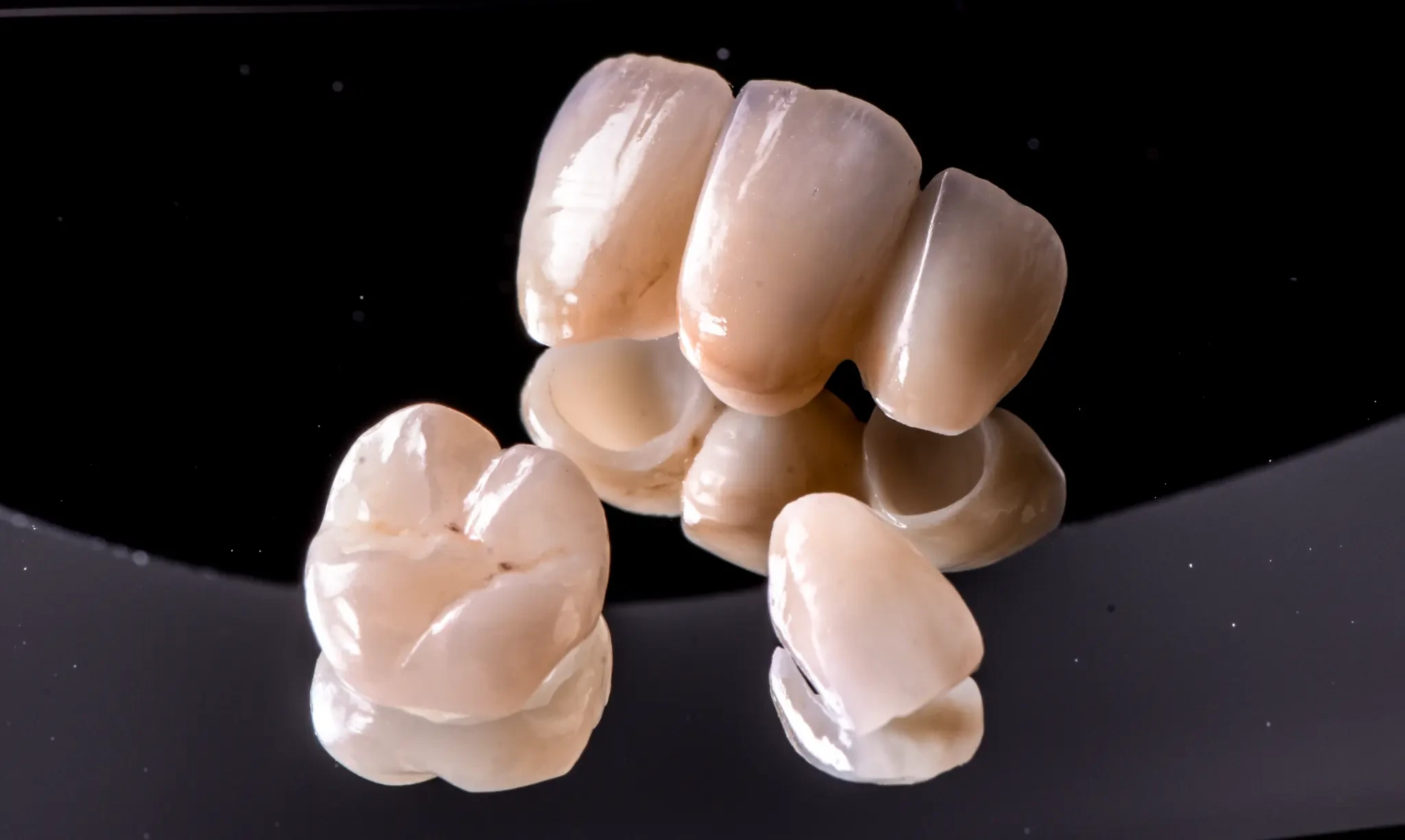 Supplied laboratory photograph of a selection of anterior and posterior dental restorations