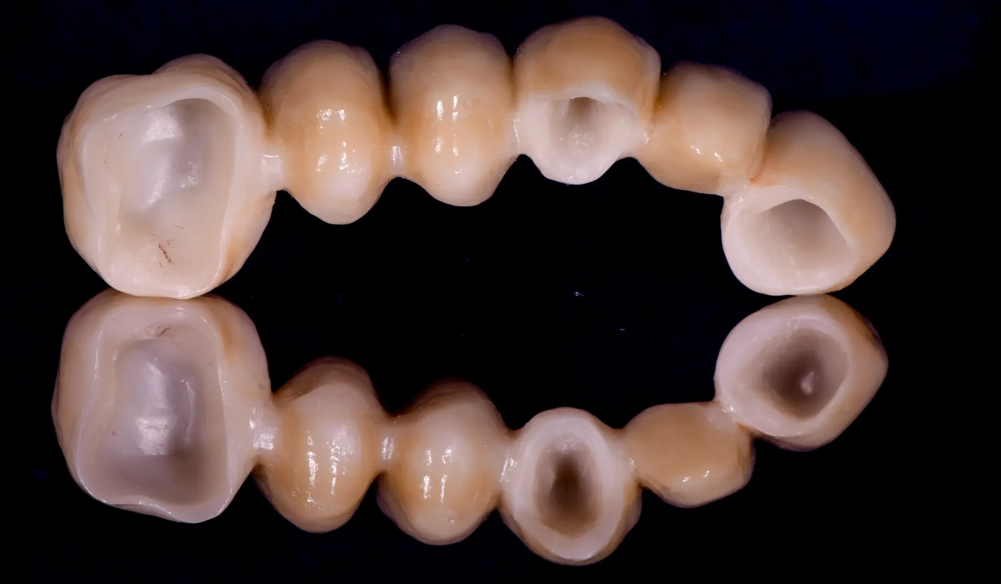 Supplied laboratory photograph of a long-span ceramic bridge with individual tooth anatomy on a reflective black surface